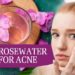 How to Use rose water for the disease of the Acne